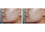 edit bulk photos retouching fast